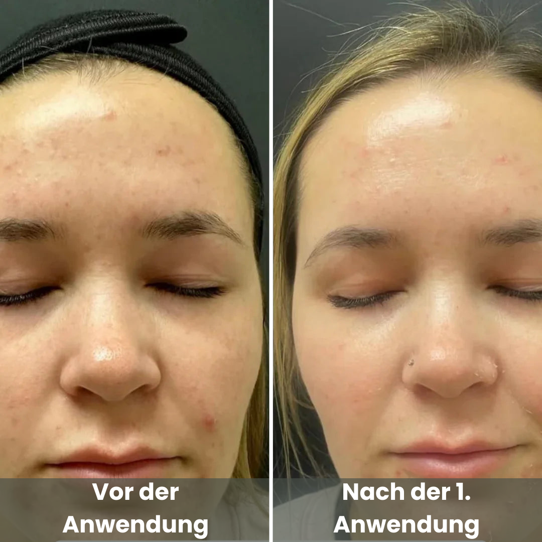 Reis Peel Shot Duo - Für ein strahlendes Gesicht