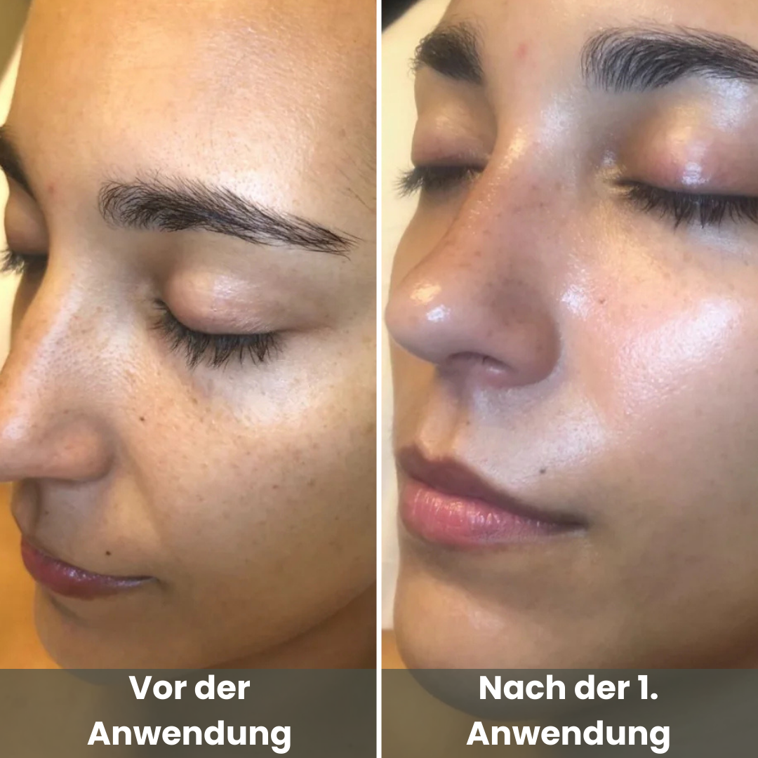 Reis Peel Shot Duo - Für ein strahlendes Gesicht