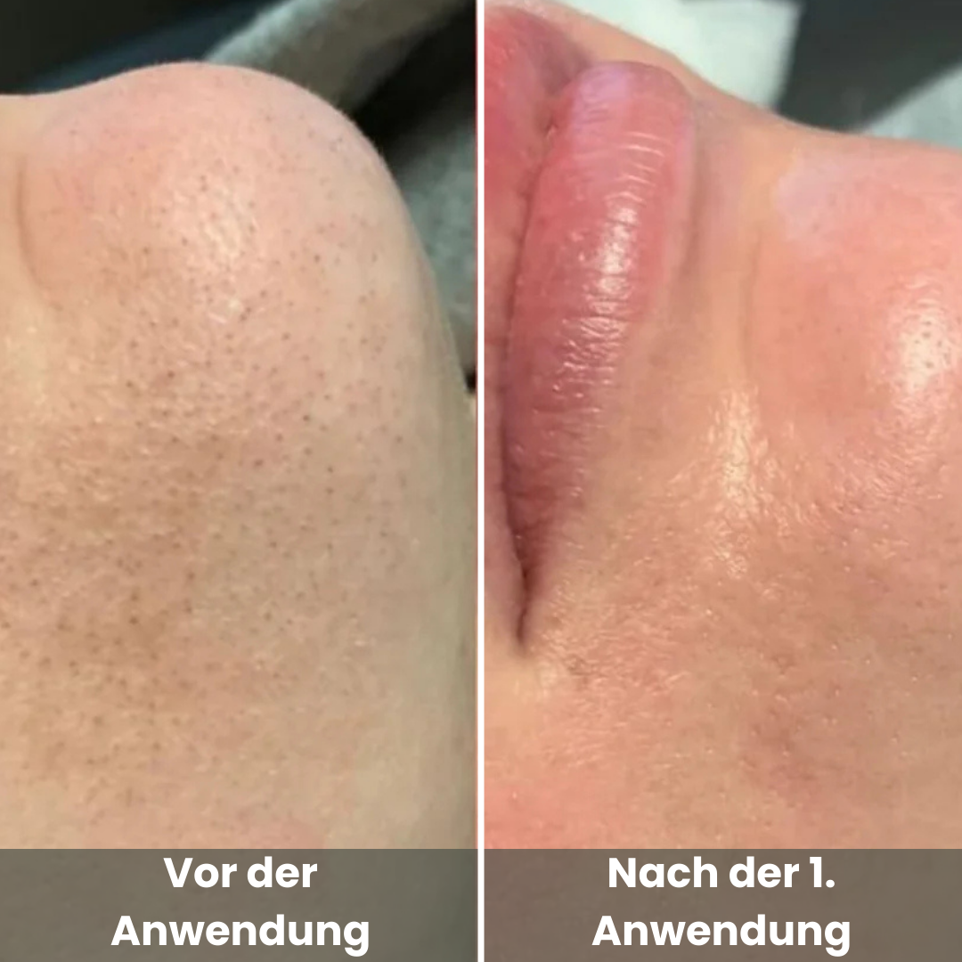 Reis Peel Shot Duo - Für ein strahlendes Gesicht